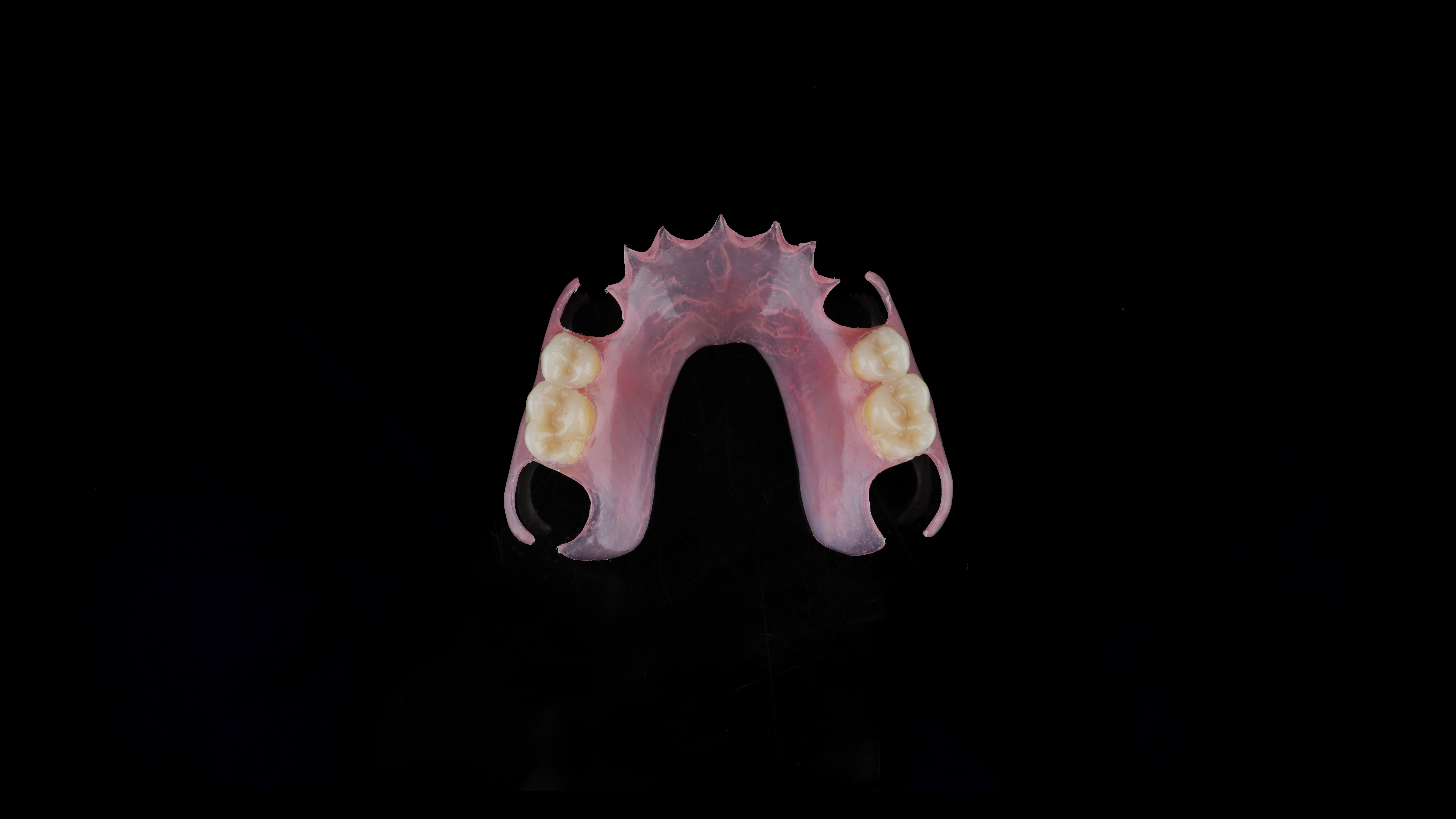 flexible denture
